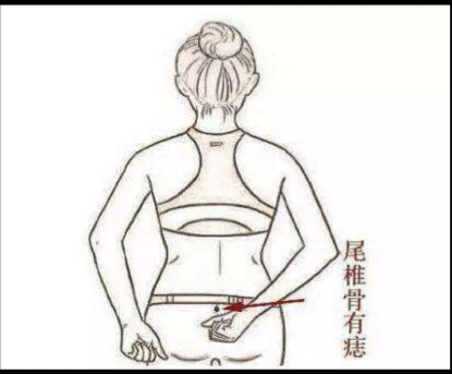 背上有痣好不好，背上長痣有什么說法？