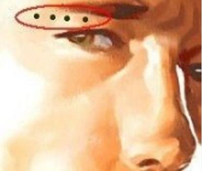 額頭上長(zhǎng)了兇痣如何化解？